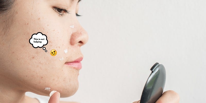 common mistakes skin breakout acne