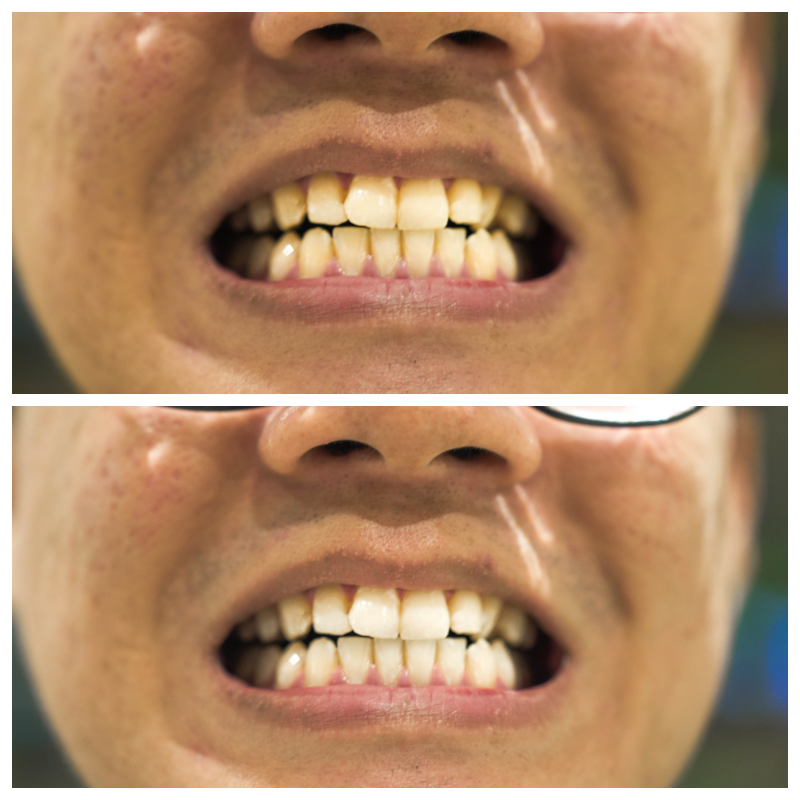 Colgate Optic White Flexlight LED