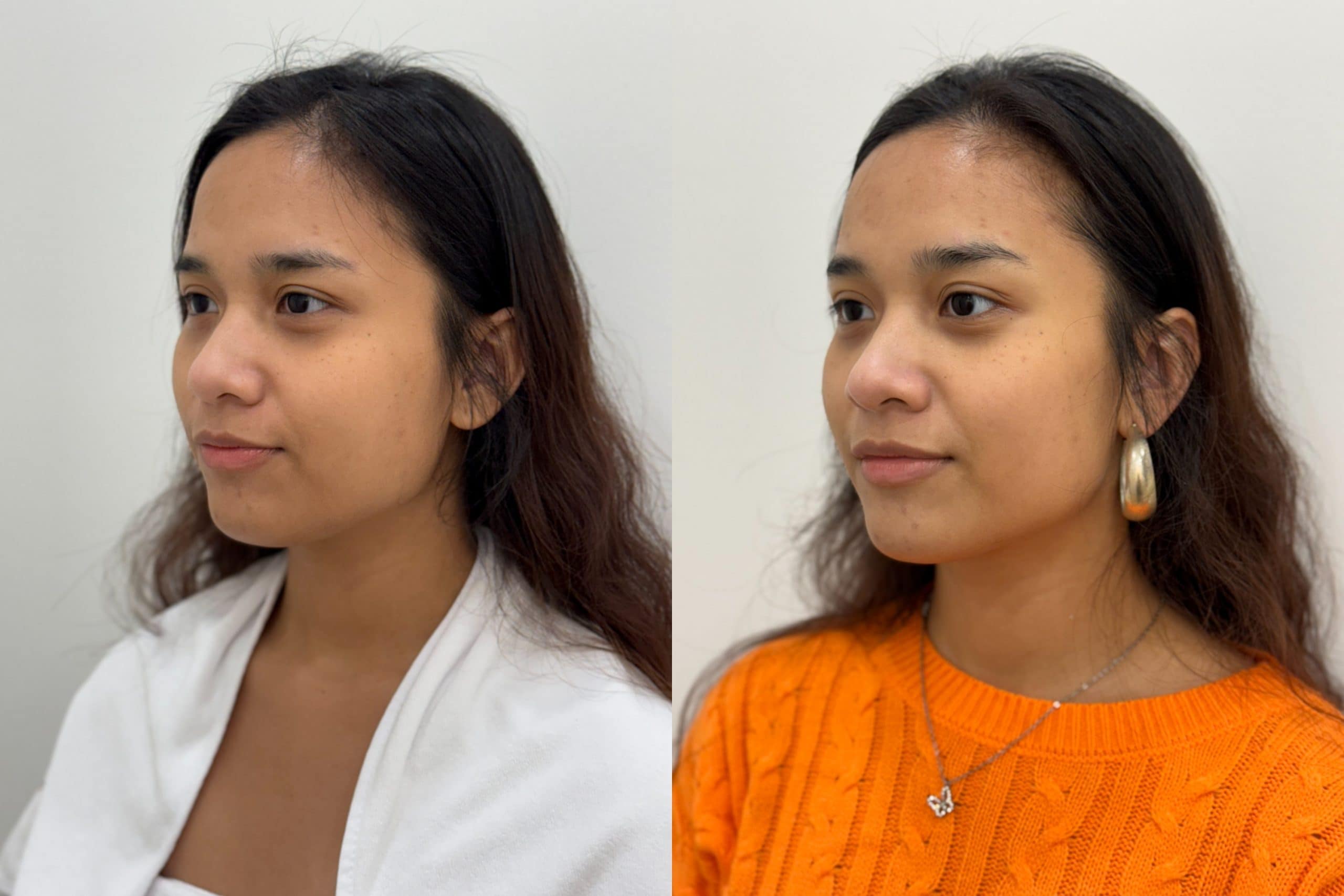 cellular renewal facial